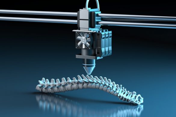 How are Spinal Implants Tested