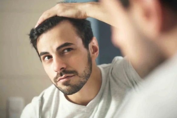 7 Key Points to Consider Before Getting a Hair Transplant