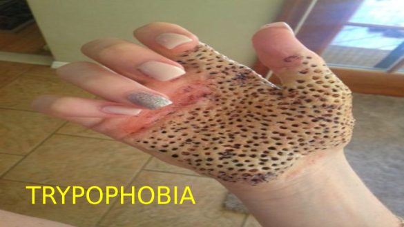 Tropophobia