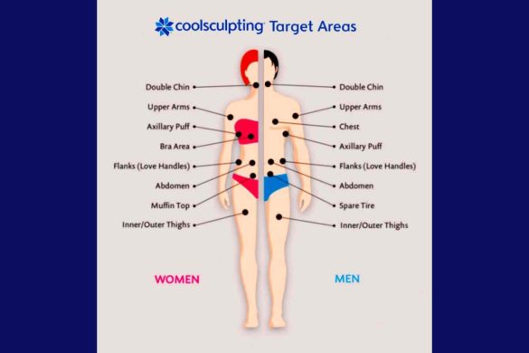 Areas Target With Coolsculpting