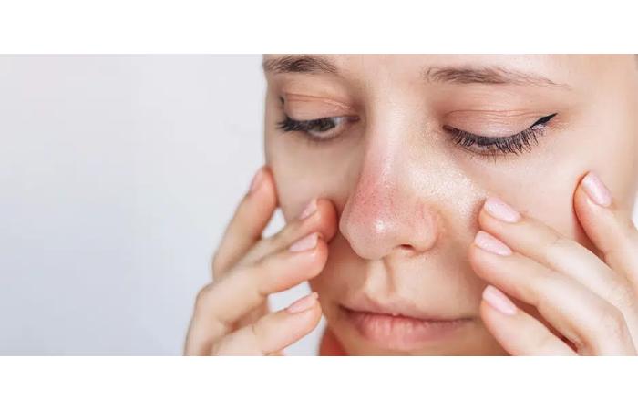 Understanding Sensitive Skin Around the Eyes